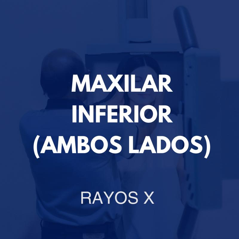 /rayosx/11