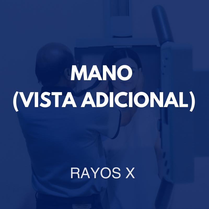 /rayosx/47