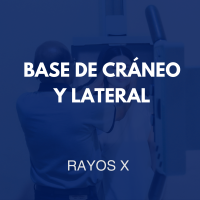 /rayosx/14
