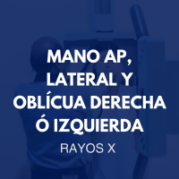 /rayosx/45