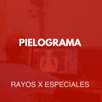 rayosxespeciales/1