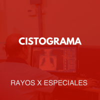 rayosxespeciales/12