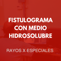 rayosxespeciales/17