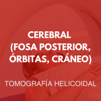 tomografia/1
