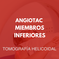 tomografia/18