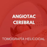 tomografia/19