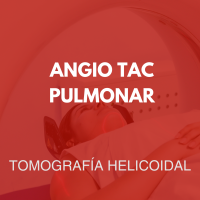 tomografia/22