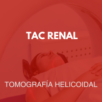tomografia/24