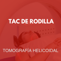 tomografia/30