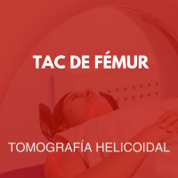 tomografia/33