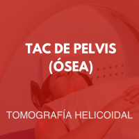 tomografia/34