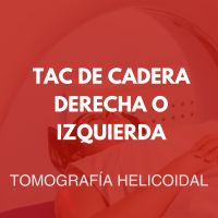 tomografia/35