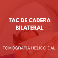 tomografia/36
