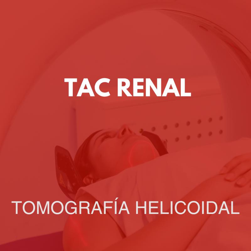 tomografia/24