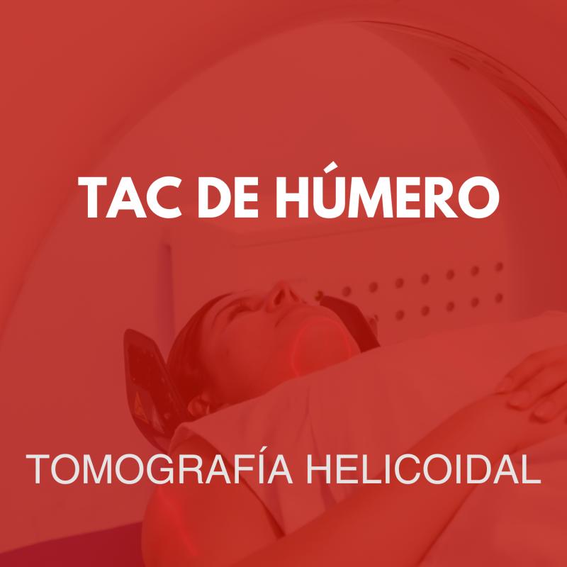 tomografia/27